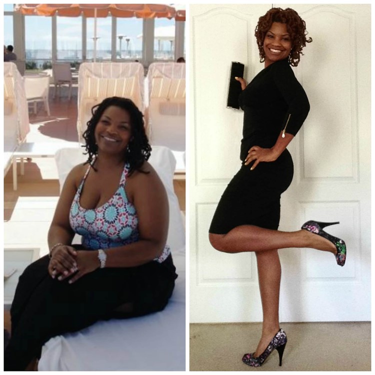 Renee Ross before and after